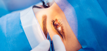 Imagem referente ao exame: SLT – Trabeculoplastia a laser